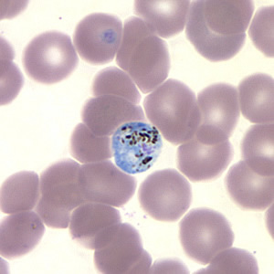 Case157_B.jpg Figure B