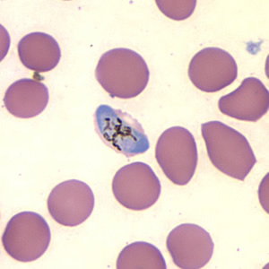 Case157_C.jpg Figure C