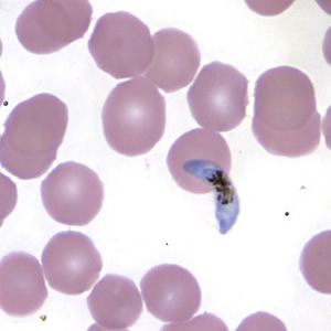 Case157_D.jpg Figure D