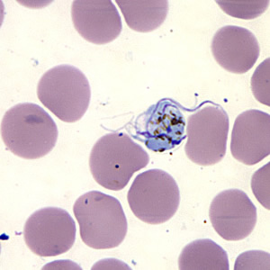 Case157_E.jpg Figure E