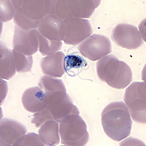 Case157_F.jpg Figure F