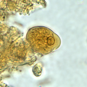 A 42-year-old man complained of diarrhea for 2 weeks following an international assignment that included travel to countries in Southeast Asia and the Indian subcontinent. 