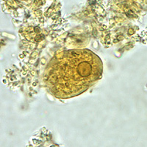 Figure B