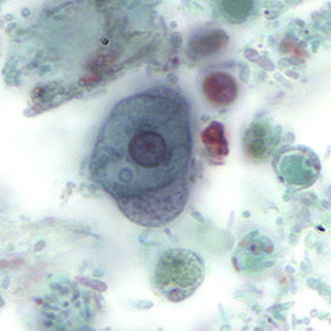 Figure C