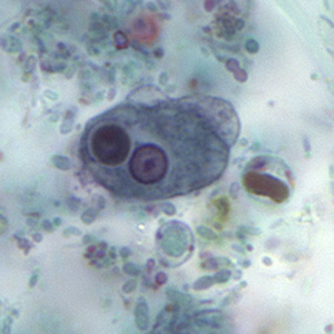 Case158_D.jpg Figure D