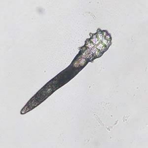 A 25-year-old woman had a few mildly scaly lesions on her forehead. She saw her physician and initially it was thought that she had a fungal lesion.