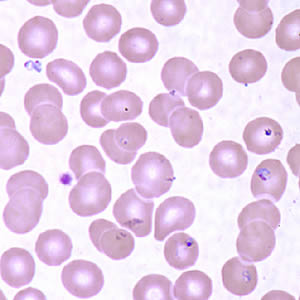 Case160_B.jpg Figure B