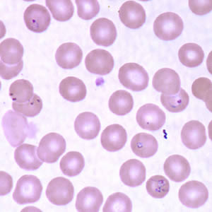 Case160_C.jpg Figure C