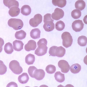 Case160_D.jpg Figure D