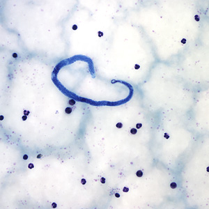 Case161_A.jpg Figure A