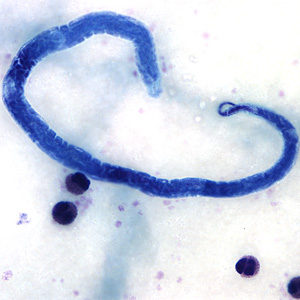 Figure B
