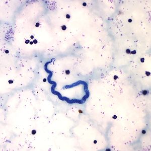 Case161_C.jpg Figure C