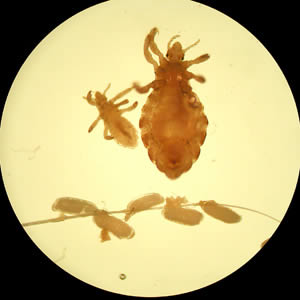 Case162_A.jpg Figure A