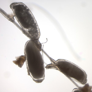 Case162_B.jpg Figure B