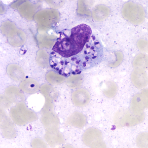 Case164_B.jpg Figure B