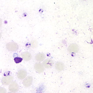 Case164_C.jpg Figure C