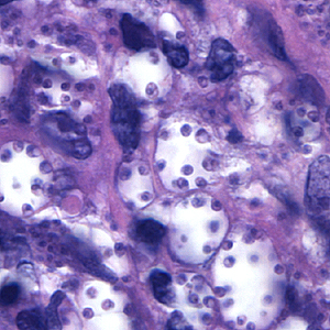 Case164_D.jpg Figure D