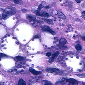 Case164_E.jpg Figure E