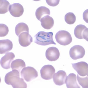 Case165_B.jpg Figure B