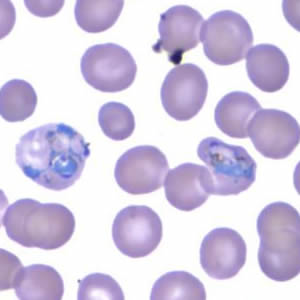 Case165_C.jpg Figure C