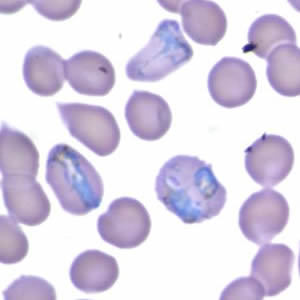 Case165_D.jpg Figure D