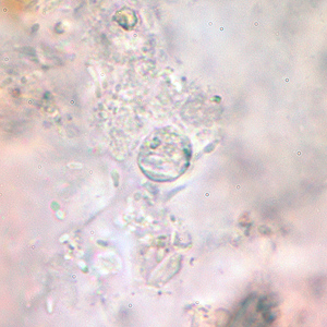 A 13-year-old boy was seen by his pediatrician for watery diarrhea, abdominal cramping, and low-grade fever that had persisted for 3 days. His symptoms began approximately 5 days after returning from a summer camp trip to a petting zoo. The physician ordered an ova and parasites (O & P) exam. 