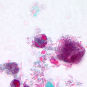 Case166_B.jpg Figure B