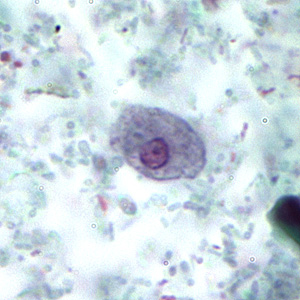 Case167_B.jpg Figure B