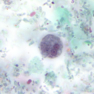 Case167_C.jpg Figure C