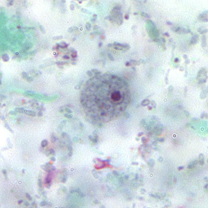 Case167_D.jpg Figure D