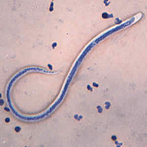 Case168_B.jpg Figure B