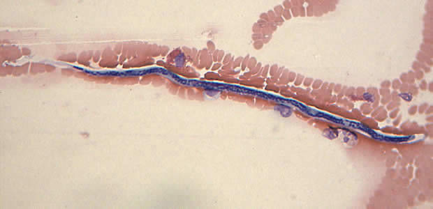 Case168_C.jpg Figure C