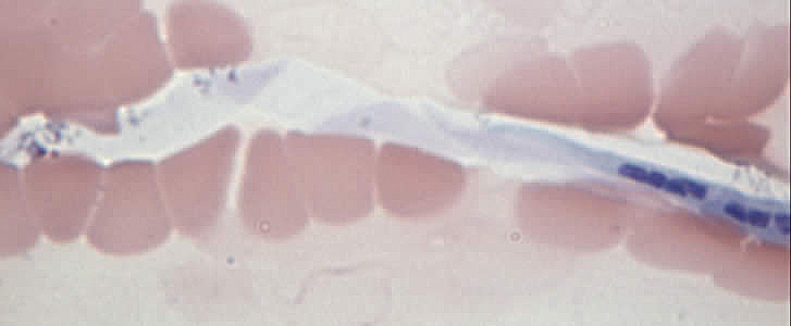 Case168_D.jpg Figure D