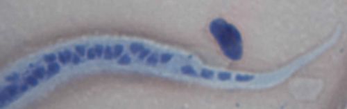 Case168_E.jpg Figure E