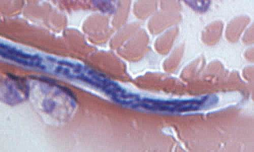 Case168_F.jpg Figure F