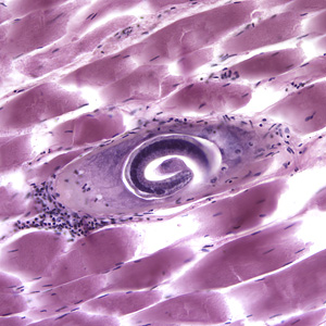 December - 2005 - Case #170 A lab worker discovered an unlabeled box of 20 pathology slides, which appeared to be stained with hematoxylin and eosin (H & E). The slides were examined to determine what was on them.