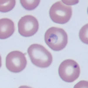 Case171_B.jpg Figure B