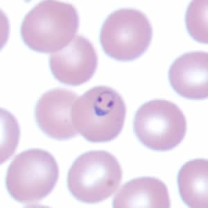 Case171_C.jpg Figure C