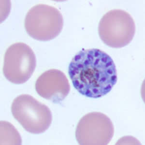 Case171_D.jpg Figure D