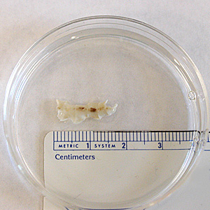 Case172_B.jpg Figure B