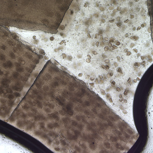 Case172_D.jpg Figure D