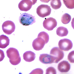 Case173_A.jpg Figure A