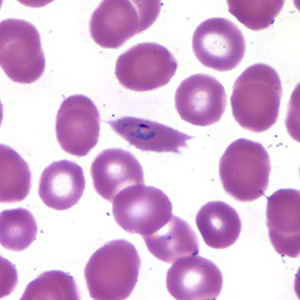 Case173_B.jpg Figure B