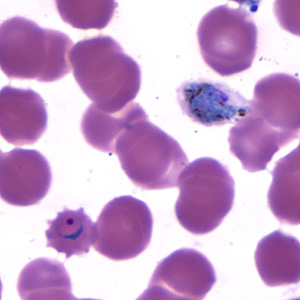 Case173_C.jpg Figure C