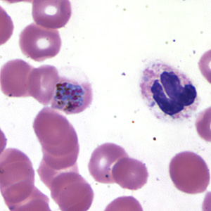 Case173_D.jpg Figure D