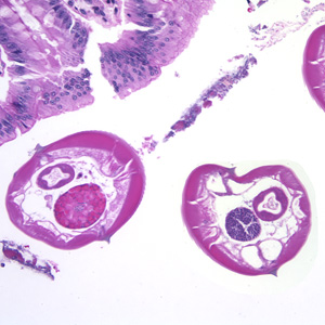 Case174_B.jpg Figure B