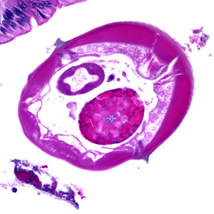 Case174_C.jpg Figure C
