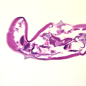 Case174_D.jpg Figure D