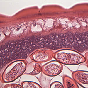 Case175_B.jpg Figure B
