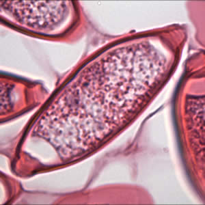 Case175_C.jpg Figure C